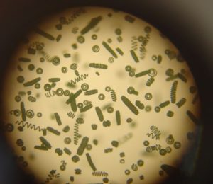 La siruline est une cyanobactérie ou une algue ou microalgue que l'on ne peut voir qu'au microscope
